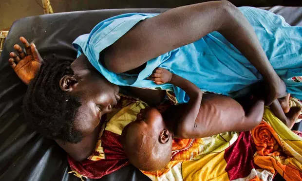 A mother breastfeeding a child with acute malnutrition at an MSF clinic in Aweil, in Northern Bahr el Ghazal state. [Photo: Albert Gonzalez Farran/AFP/Getty Images]