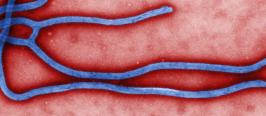 The Ebola virus. (CDC photo)