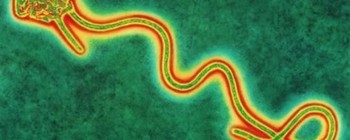 Photo: An image of an Ebola virus BBC/Science Photo Library