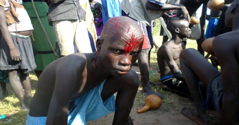 A boy during a traditional head scarification ceremony in Gogrial, Warrap State, South Sudan on October 1, 2015: (Photo: The Niles)