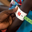 Photo: A child is assessed for malnutrition in Fashoda State. (Radio Tamazuj)