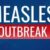 Warrap State declares measles outbreak in Tonj East County